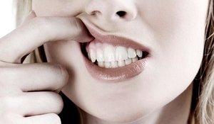 alveolit suvi alveolit, dry socket